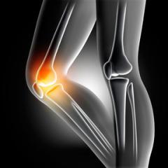 Строение и анатомия коленного сустава человека Как выглядят и где расположены мениски